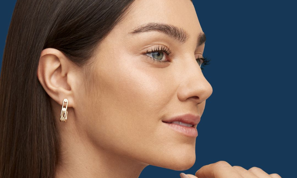 radiesse dermal filler