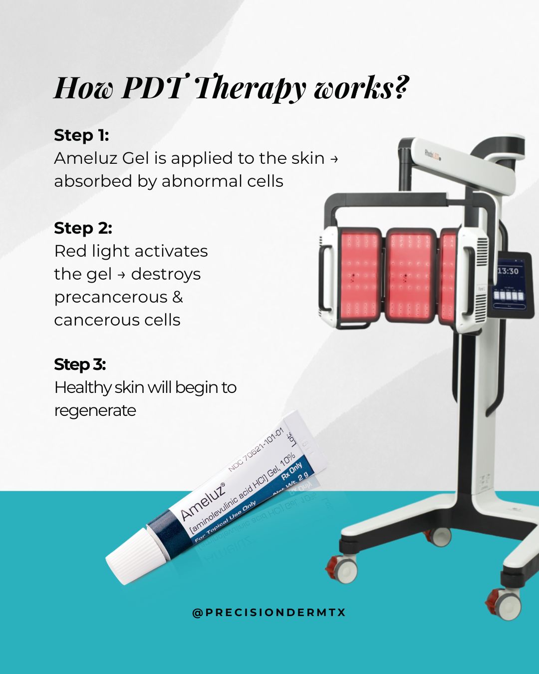 Photodynamic Therapy for actinic keratoses