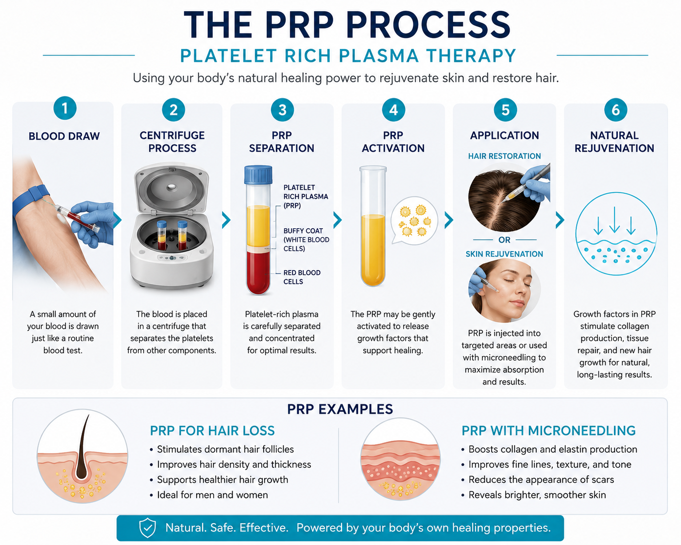 The PRP process how it works