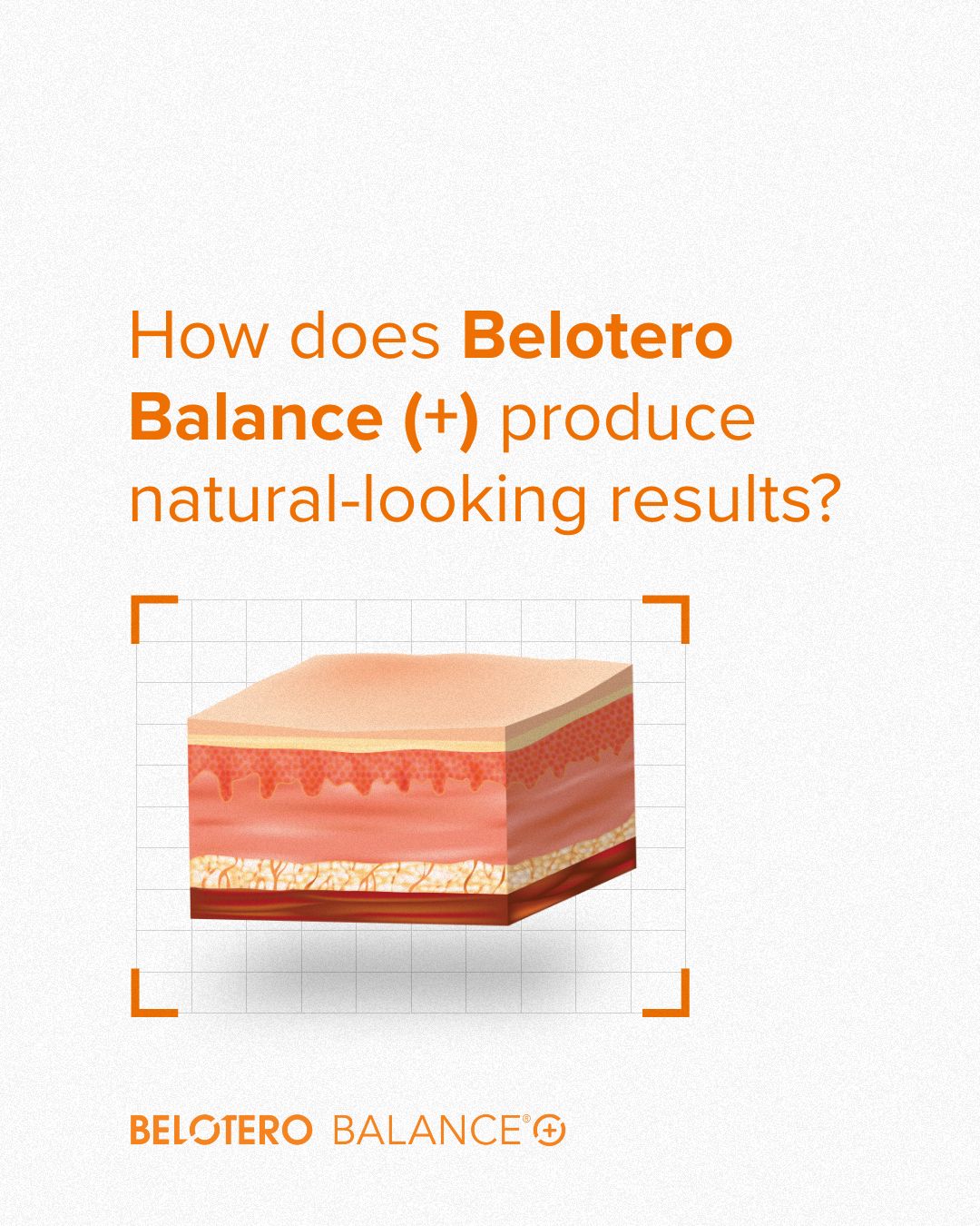 how does belotero work