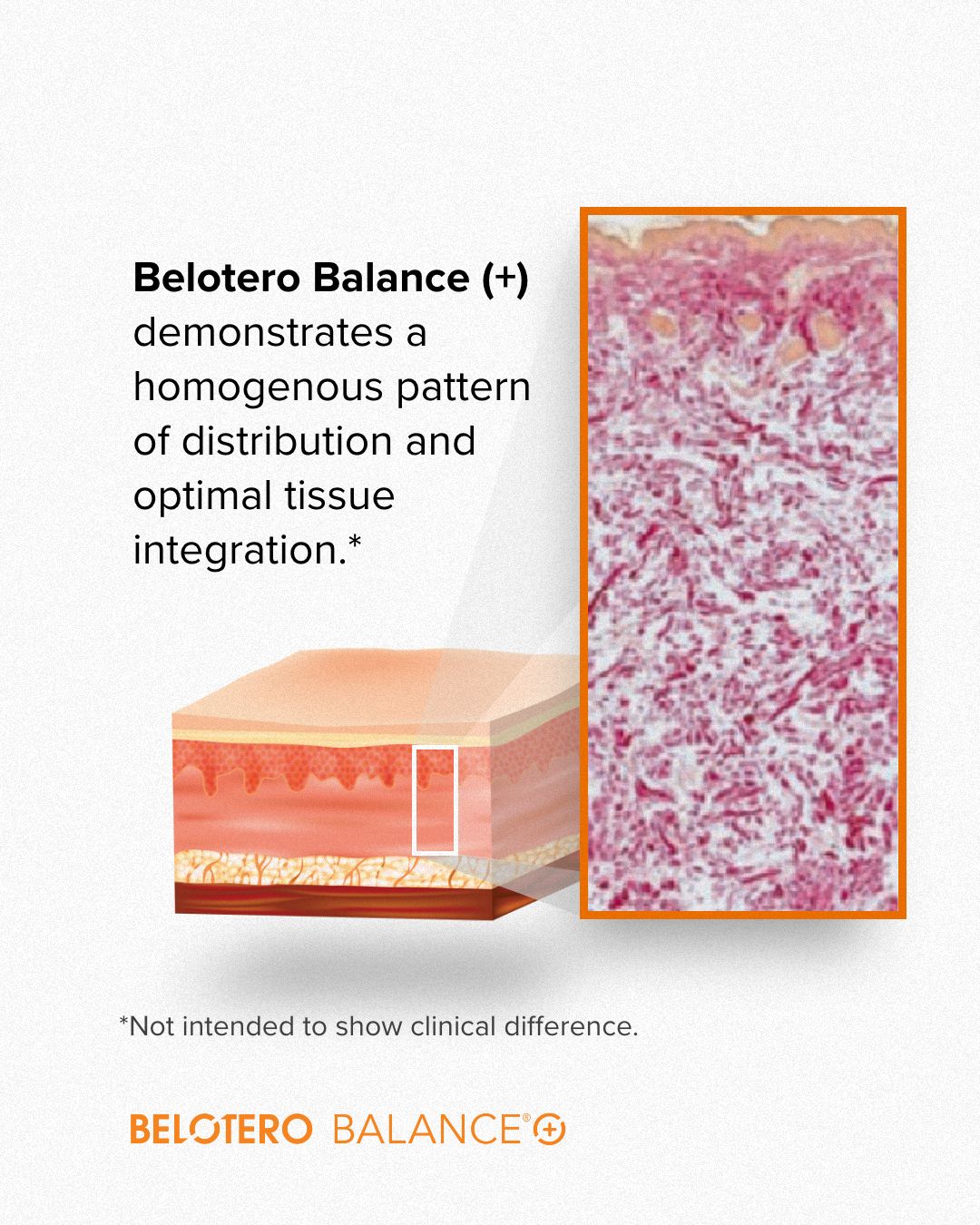natural looking belotero results