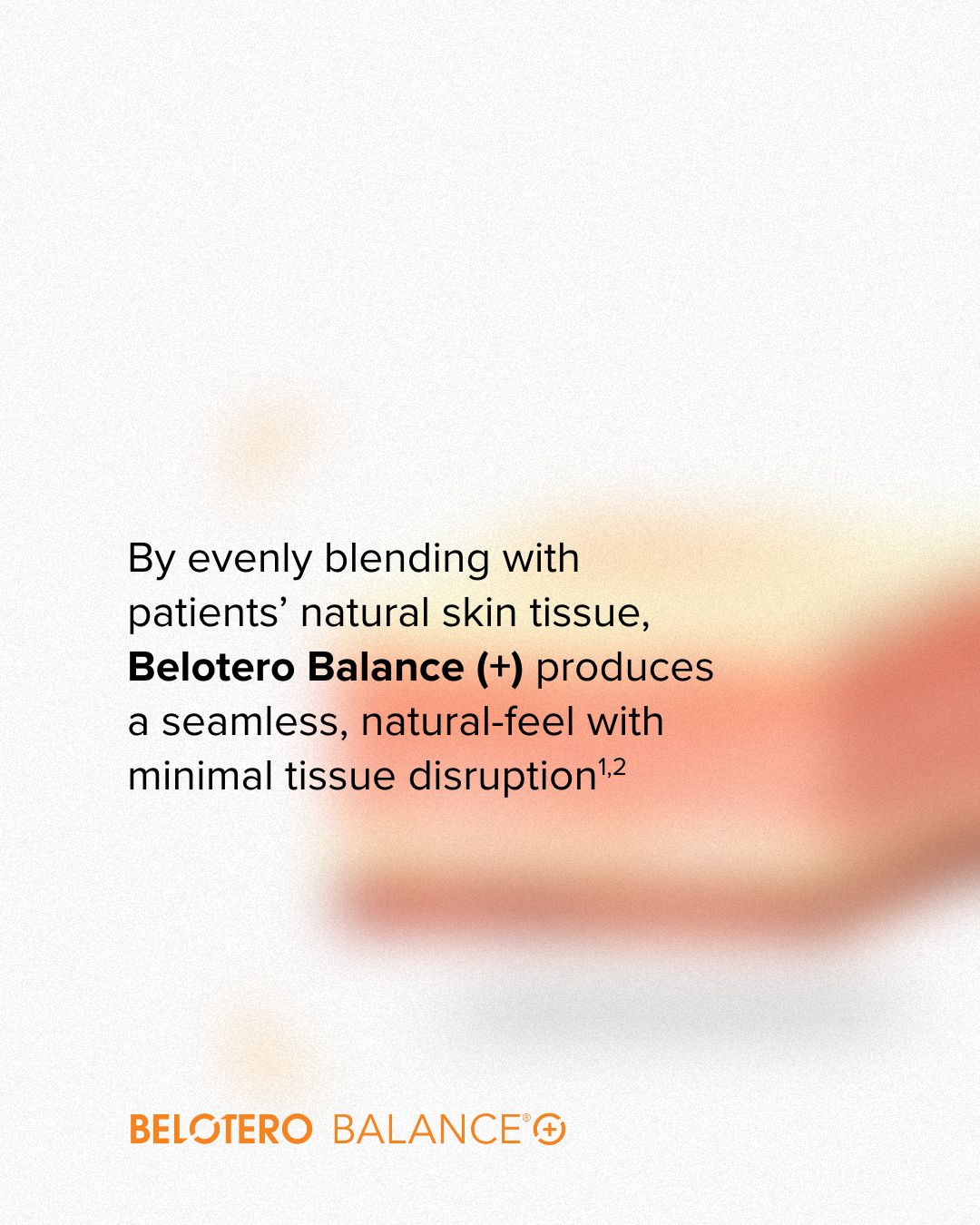 belotero natural results